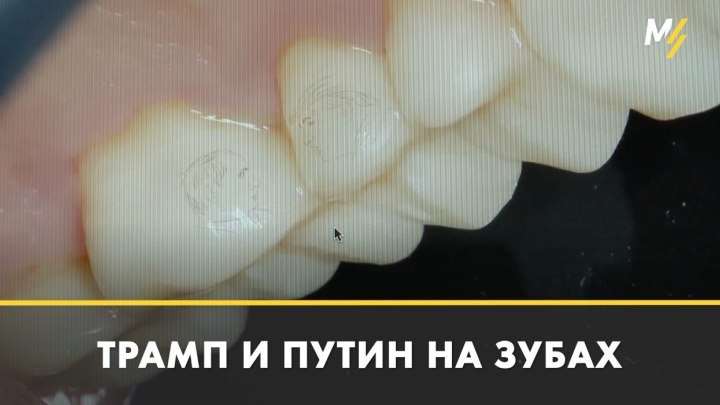 Пациенту имплантировали зубы с Трампом и Путиным