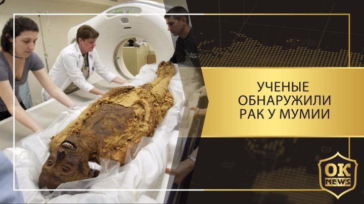 Ученые обнаружили рак у мумии