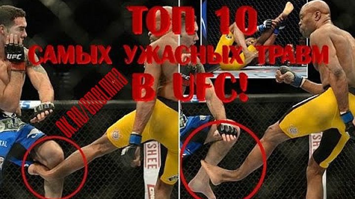 ★ ТОП 10 САМЫХ УЖАСНЫХ ТРАВМ В UFC ★