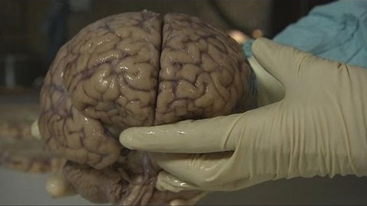 Тайны человеческого мозга - futuris
