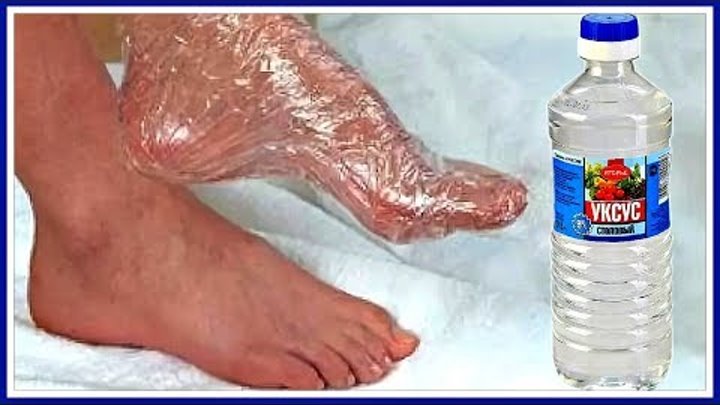 Как убрать боль в ягодицах - YouTube