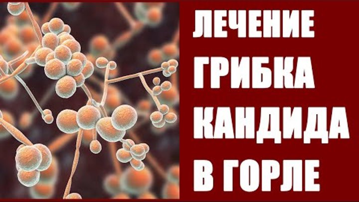 Эзофагит: симптомы и лечение, профилактика и возможные осложнения
