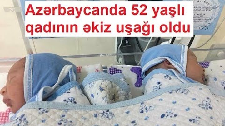Azərbaycanda 52 yaşlı qadının əkiz uşağı oldu Azərbaycanda 52 yaşlı qadının əkiz uşağı oldu