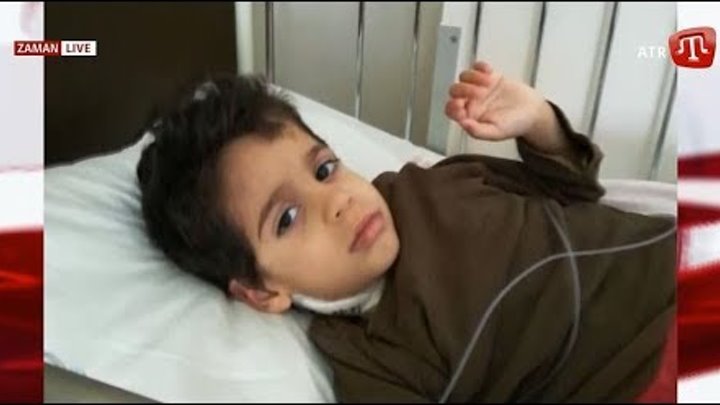 Нашої з вами допомоги потребує 3-річний Юнус Шафі, хворий на важку форму лейкозу