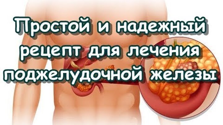 Панкреатит: причины и лечение. Как лечить острый и хронический панкреатит поджел