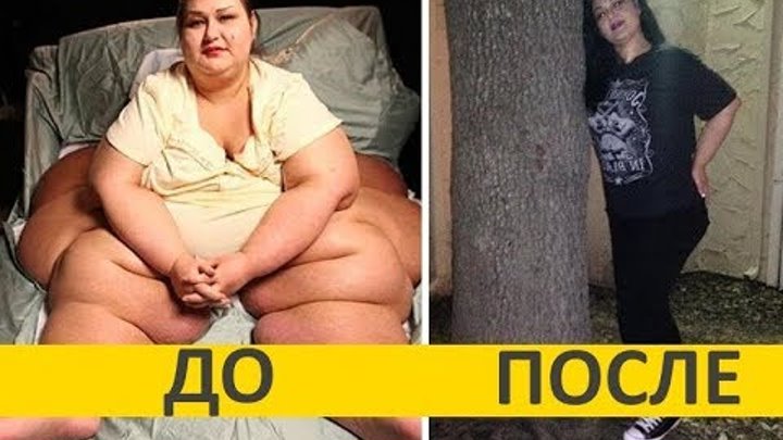 Самая толстая женщина в мире 500 кг. Майра Розалес- моя ужасная история