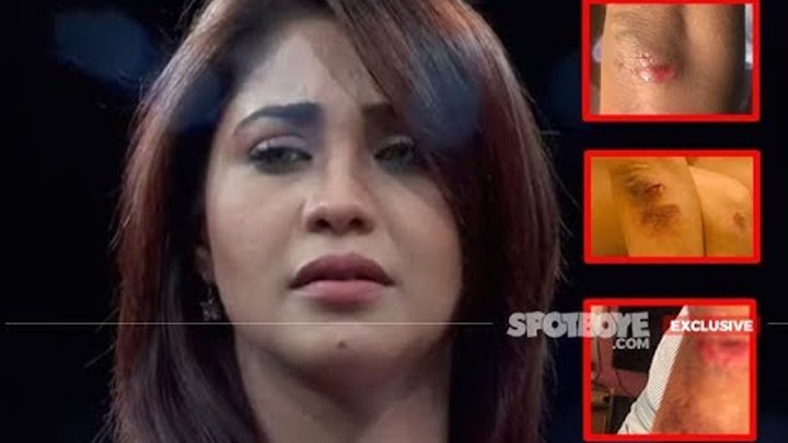 OMG! Fan Badly Injures Amrapali Gupta For Playing Negative In Qubool Hai смотреть онлайн OMG! Fan Badly Injures Amrapali Gupta For Playing Negative In Qubool Hai