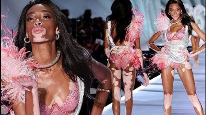 Winnie Harlow - Винни Харлоу | Топ-модель по-американски смотреть онлайн Winnie Harlow - Винни Харлоу | Топ-модель по-американски