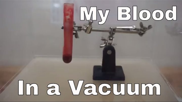What Happens When I Put My Own Blood In A Vacuum Chamber? Will It Boil Or Turn Blue? What Happens When I Put My Own Blood In A Vacuum Chamber? Will It Boil Or Turn Blue?