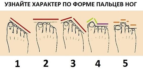 Какие бывают пальцы ног. Форма стопы. Типы расположения пальцев на ноге. Форма пальцев на ногах. Греческая форма стопы.